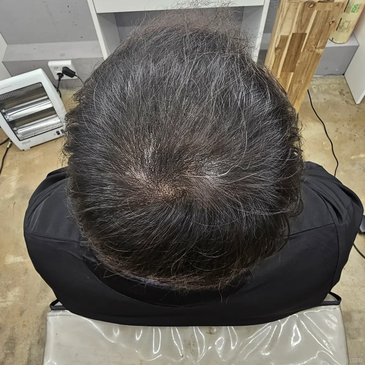 두피페인팅 (치트염색) 시술 후 결과 사진 6