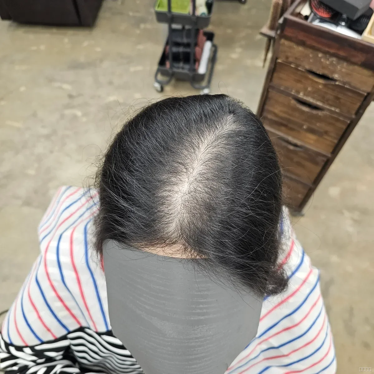 두피페인팅 (치트염색) 시술 전 사진 1