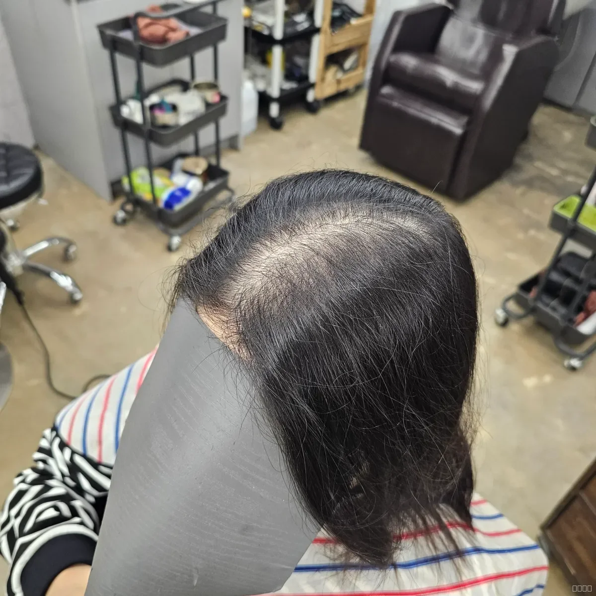 두피페인팅 (치트염색) 시술 전 사진 3