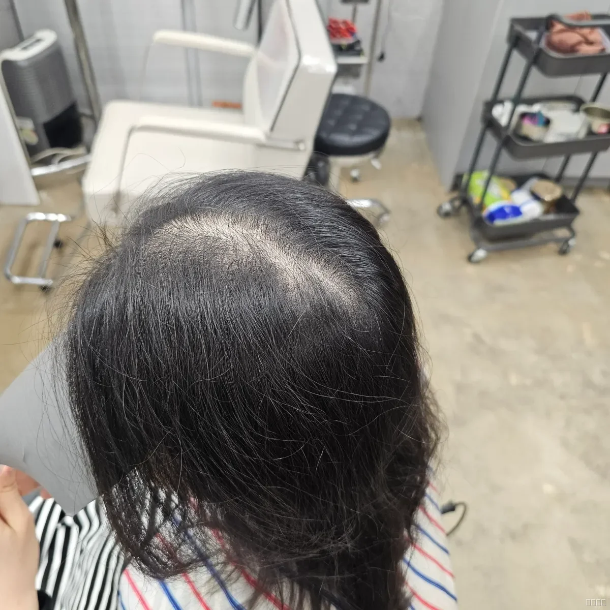 두피페인팅 (치트염색) 시술 전 사진 4