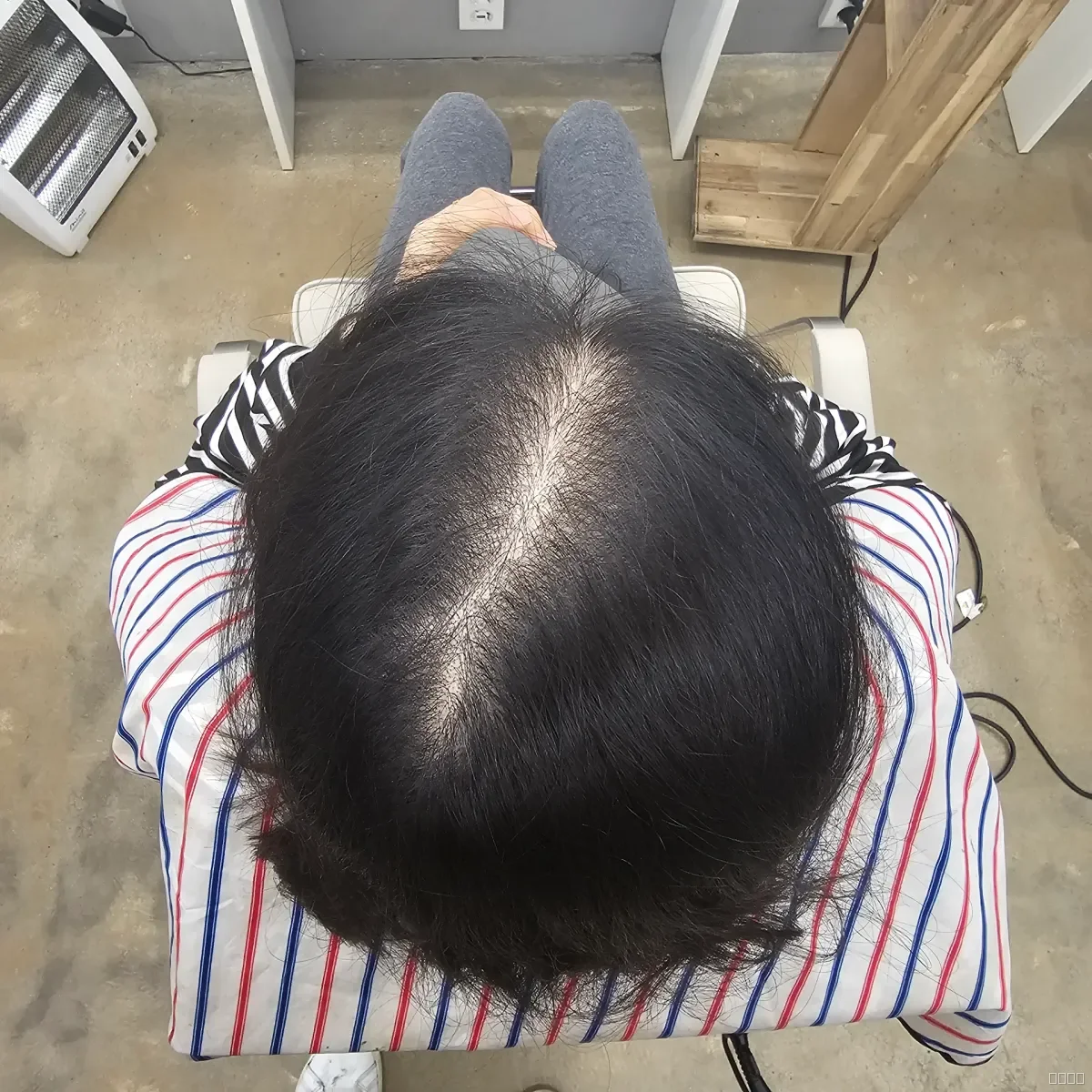 두피페인팅 (치트염색) 시술 전 사진 5