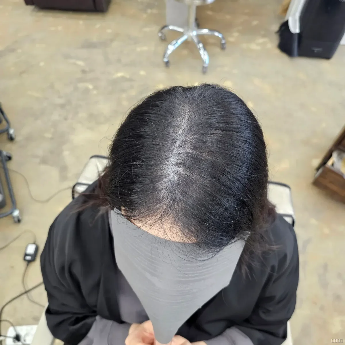 두피페인팅 (치트염색) 시술 후 결과 사진 1