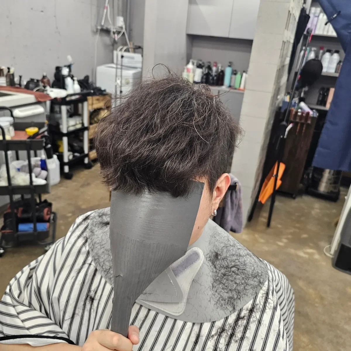 탈모 치트펌 시술 전 사진 1