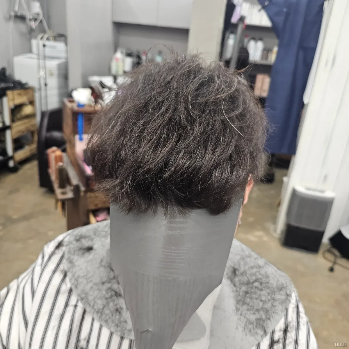 탈모 치트펌 시술 전 사진 2