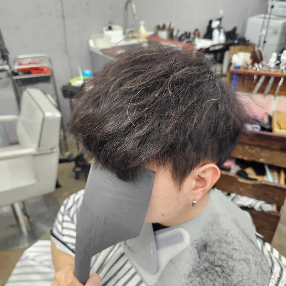 탈모 치트펌 시술 전 사진 3