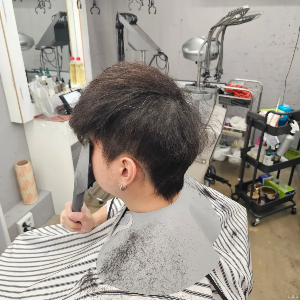 탈모 치트펌 시술 전 사진 4