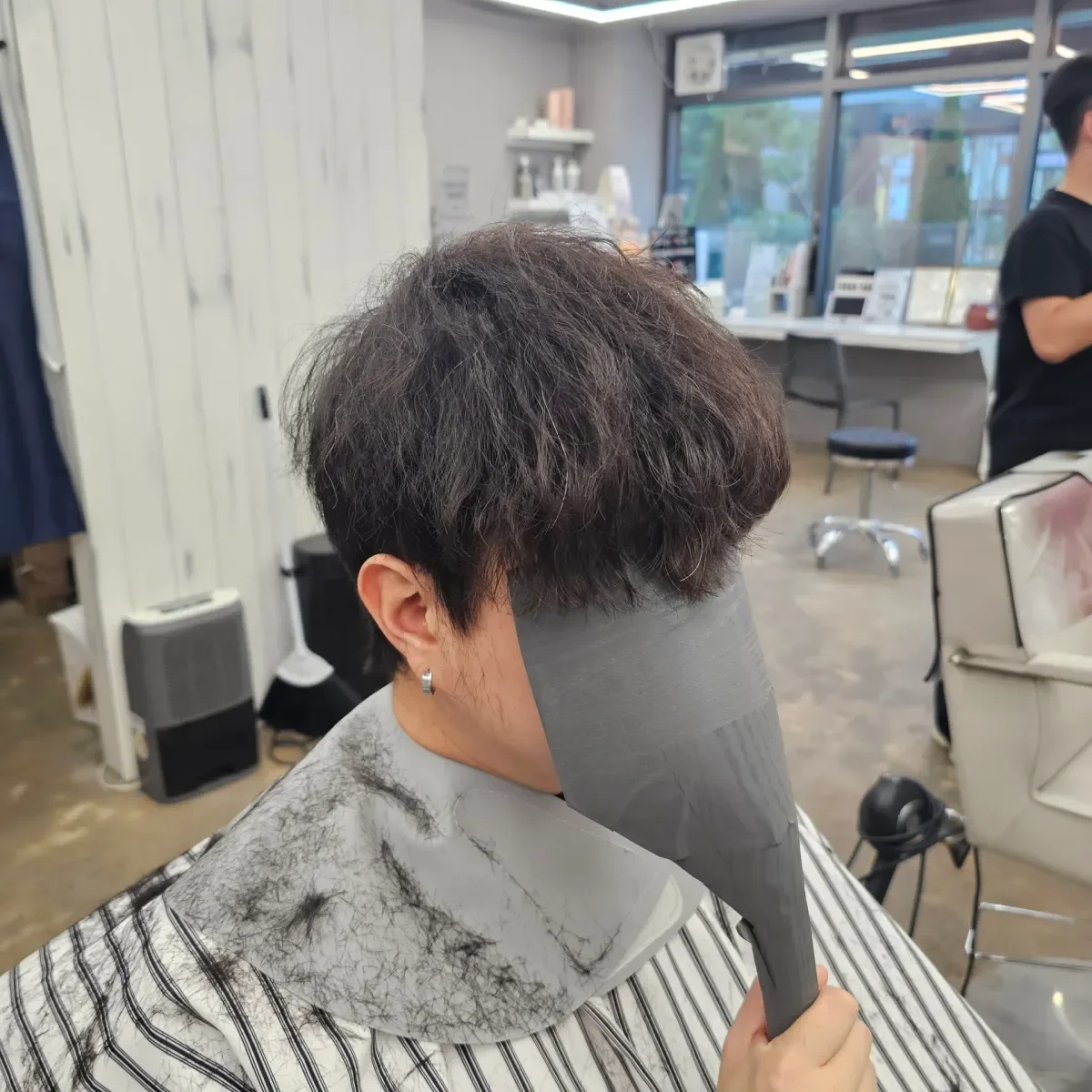 탈모 치트펌 시술 전 사진 5