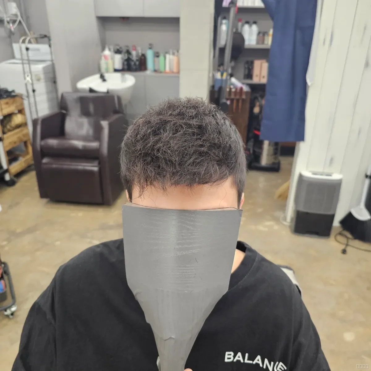 탈모 치트펌 시술 후 결과 사진 1