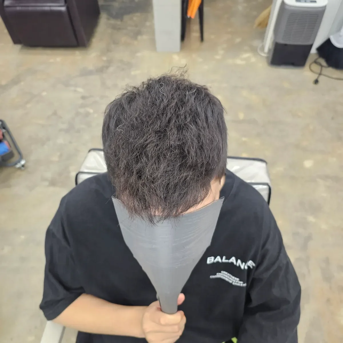 탈모 치트펌 시술 후 결과 사진 2