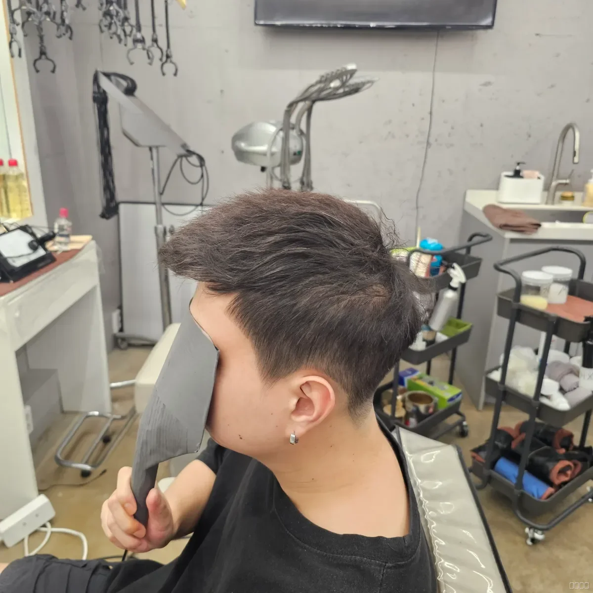 탈모 치트펌 시술 후 결과 사진 4