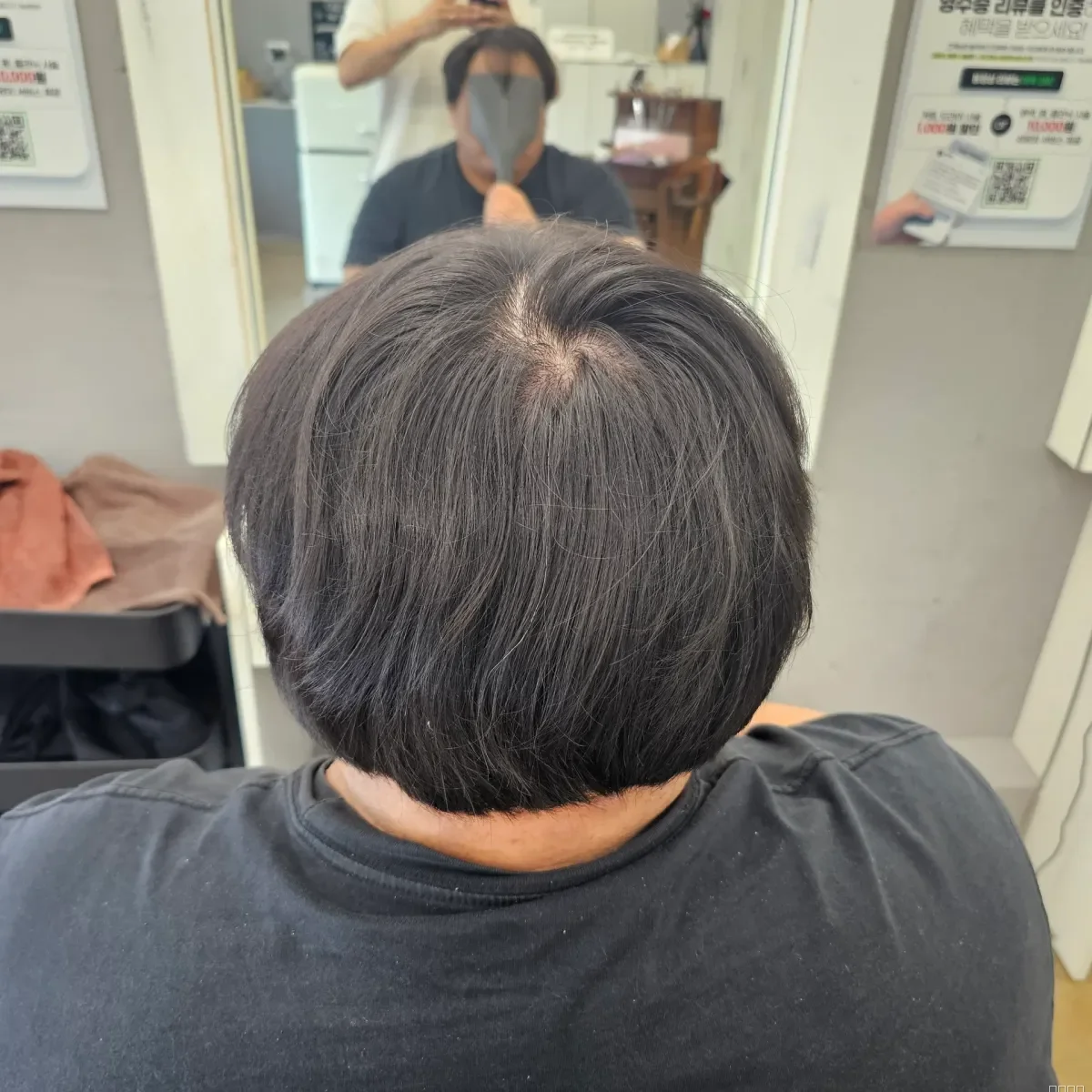 탈모 치트펌 시술 전 사진 4