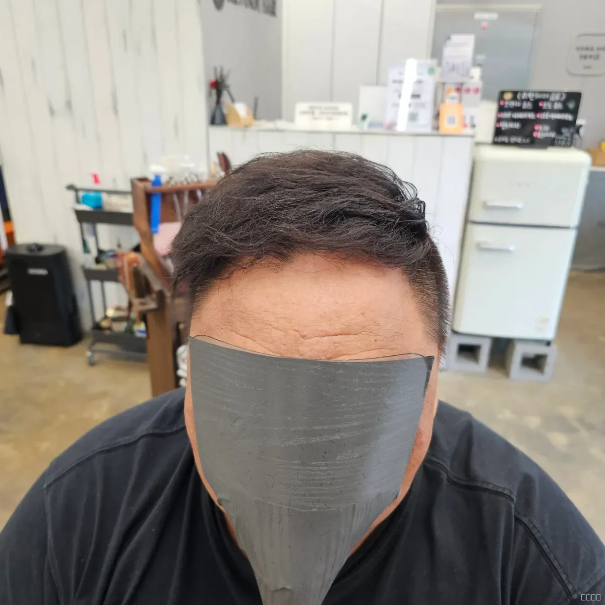 탈모 치트펌 시술 후 결과 사진 1