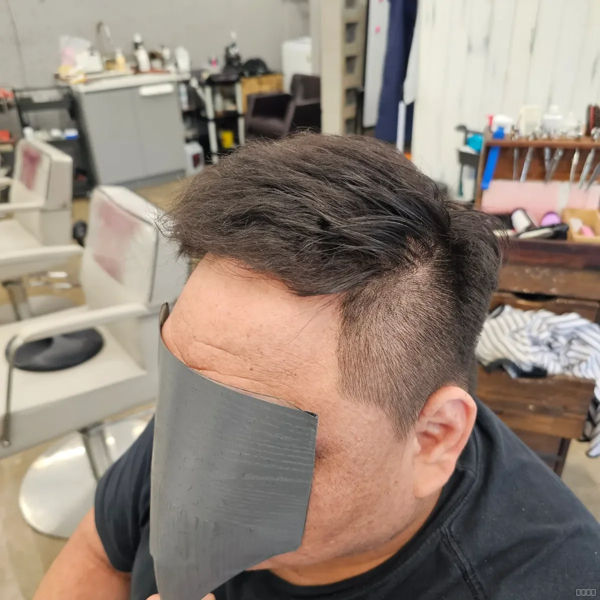 탈모 치트펌 시술 후 결과 사진 2