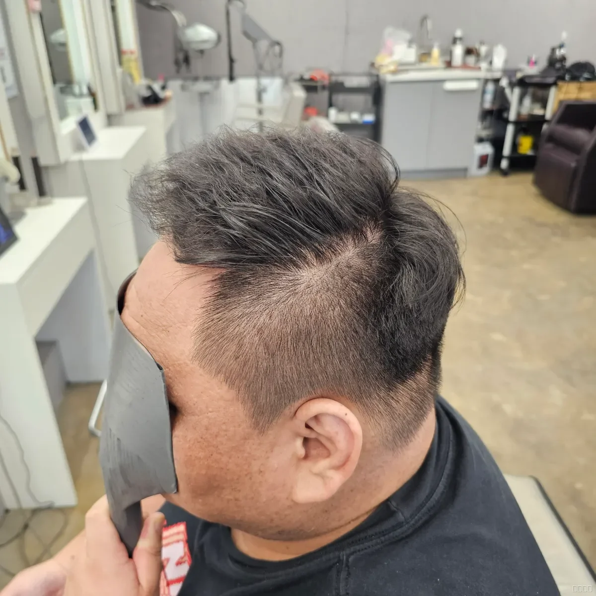 탈모 치트펌 시술 후 결과 사진 3