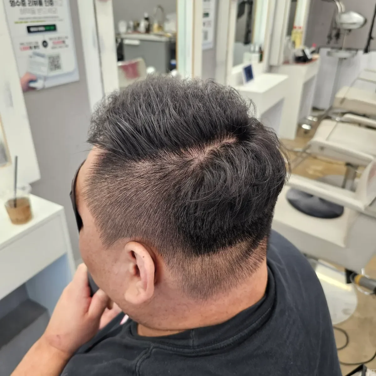 탈모 치트펌 시술 후 결과 사진 4