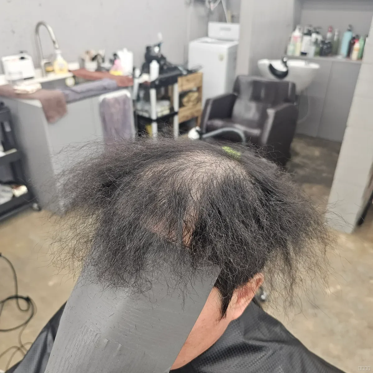 탈모 치트펌 파마 시술 전 사진 3