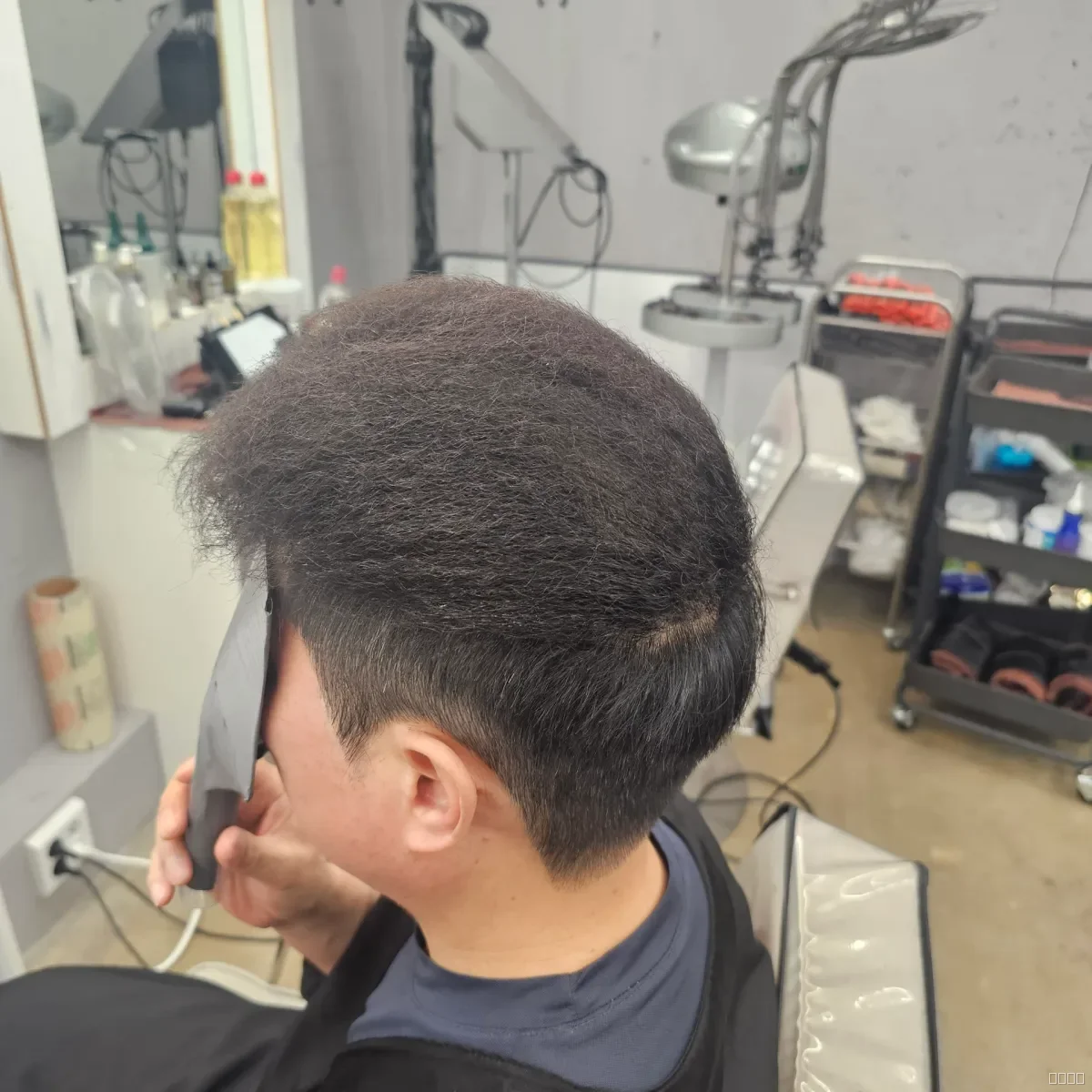 탈모 치트펌 파마 시술 후 결과 사진 4