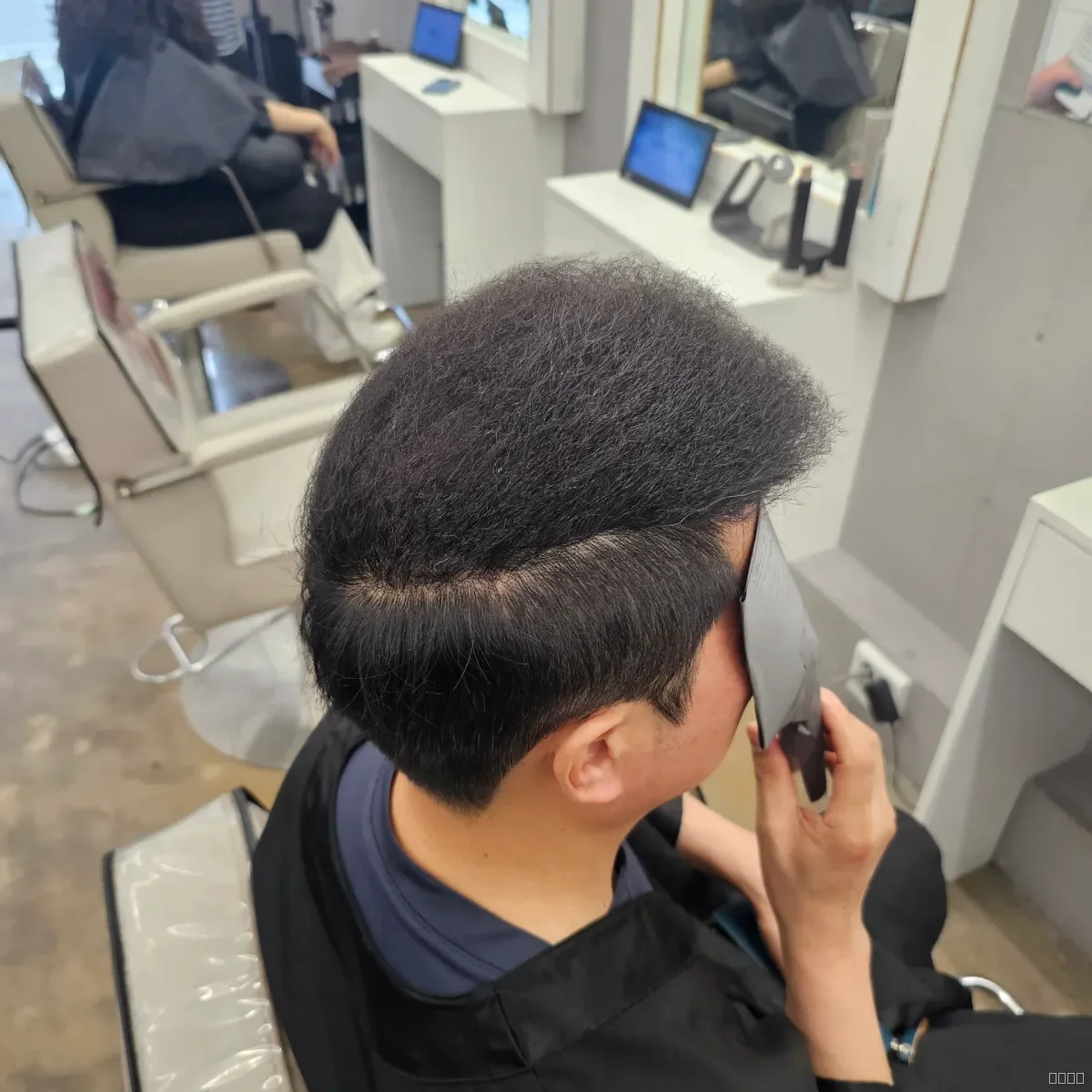 탈모 치트펌 파마 시술 후 결과 사진 7