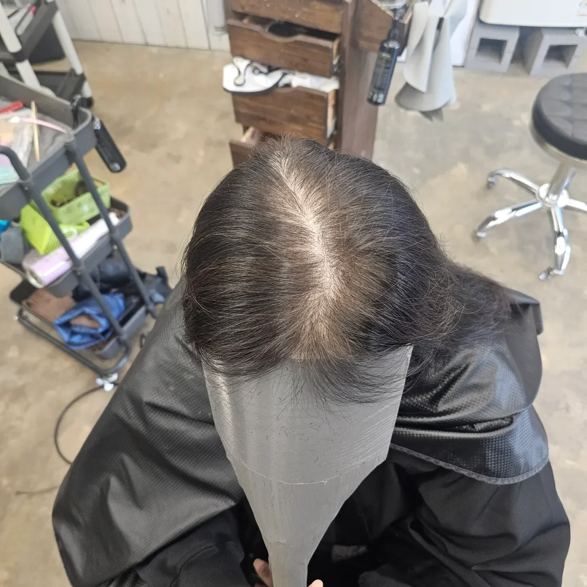 회춘펌 (뿌리볼륨 교정펌) 시술 전 사진