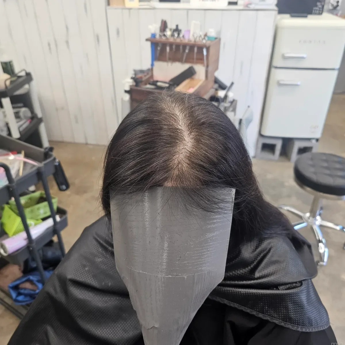 회춘펌 (뿌리볼륨 교정펌) 시술 전 사진 2