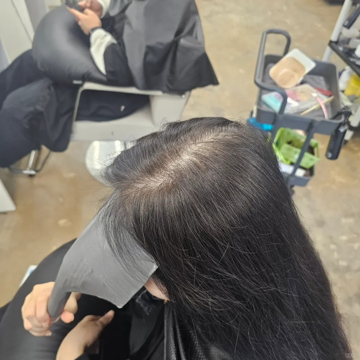 회춘펌 (뿌리볼륨 교정펌) 시술 전 사진 3