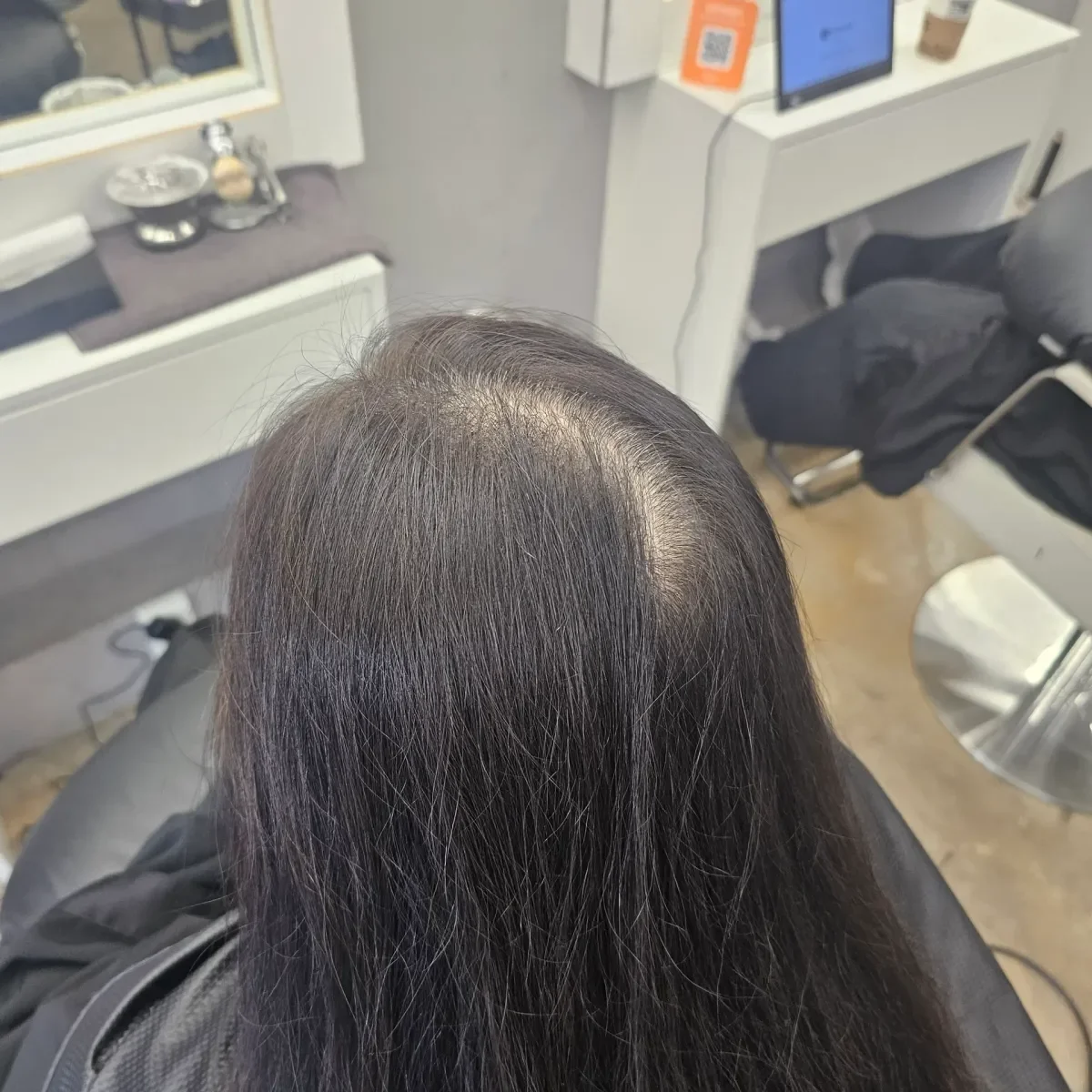 회춘펌 (뿌리볼륨 교정펌) 시술 전 사진 4