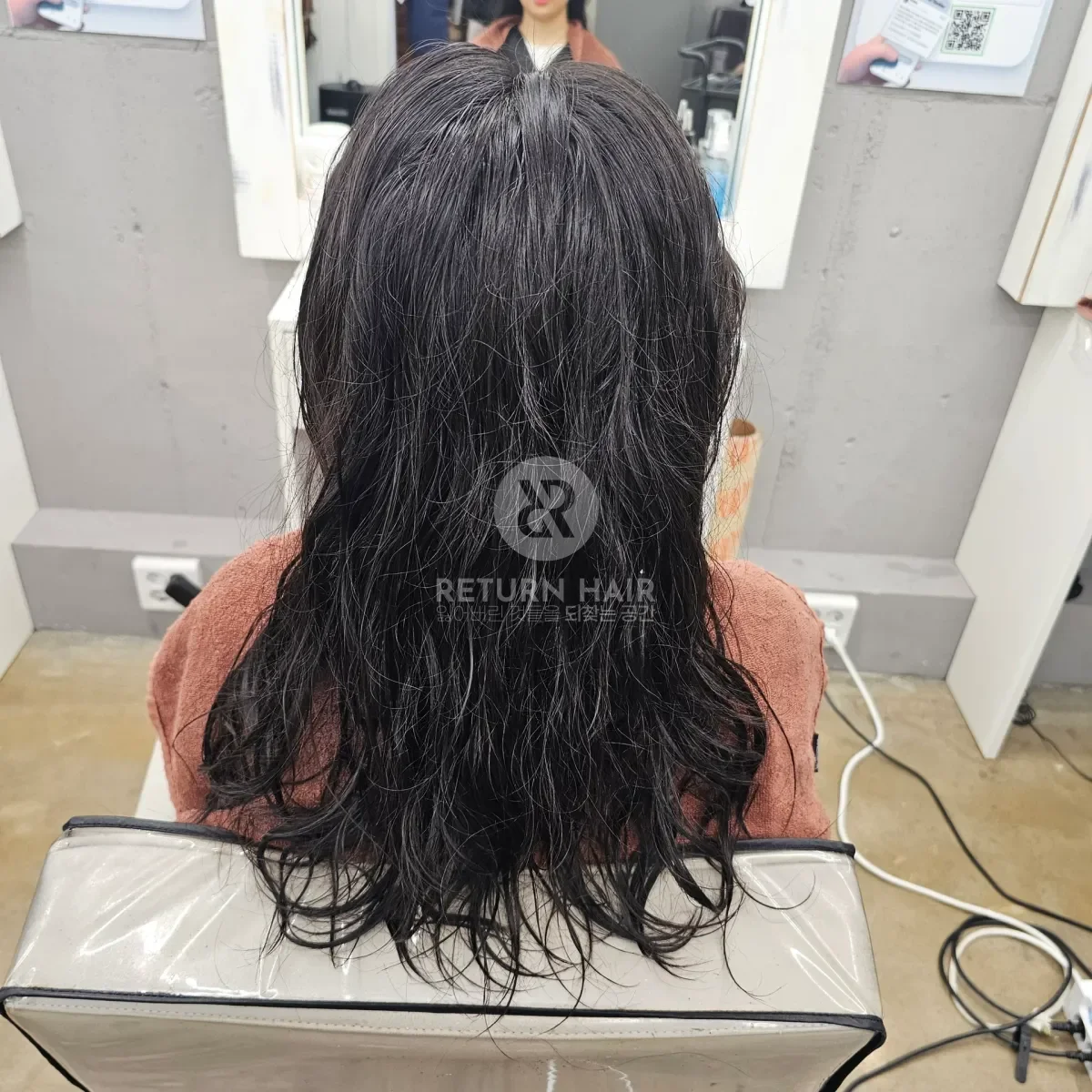 리턴 복구셋팅펌 시술 전 사진 3