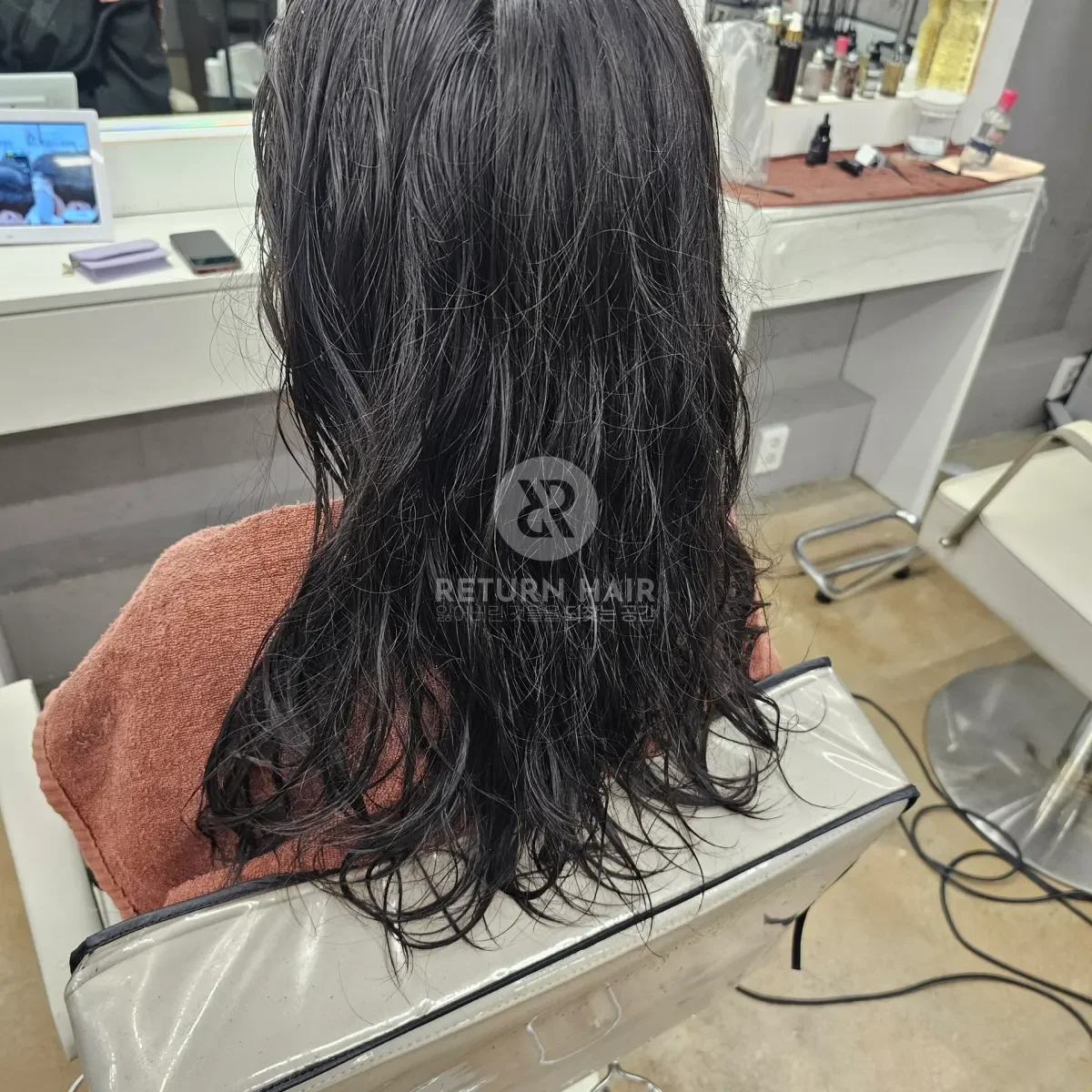 리턴 복구셋팅펌 시술 전 사진 4