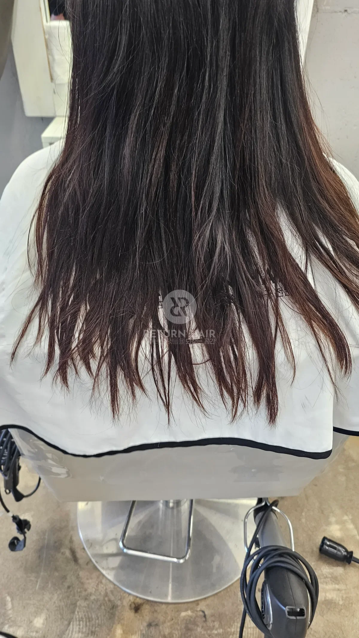 리턴 복구매직 시술 전 사진