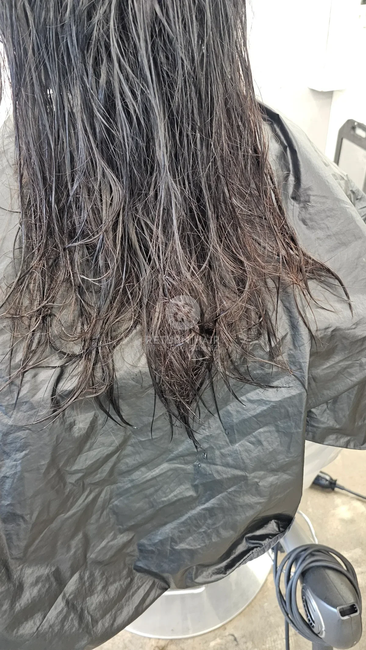 리턴 복구매직 시술 전 사진 5