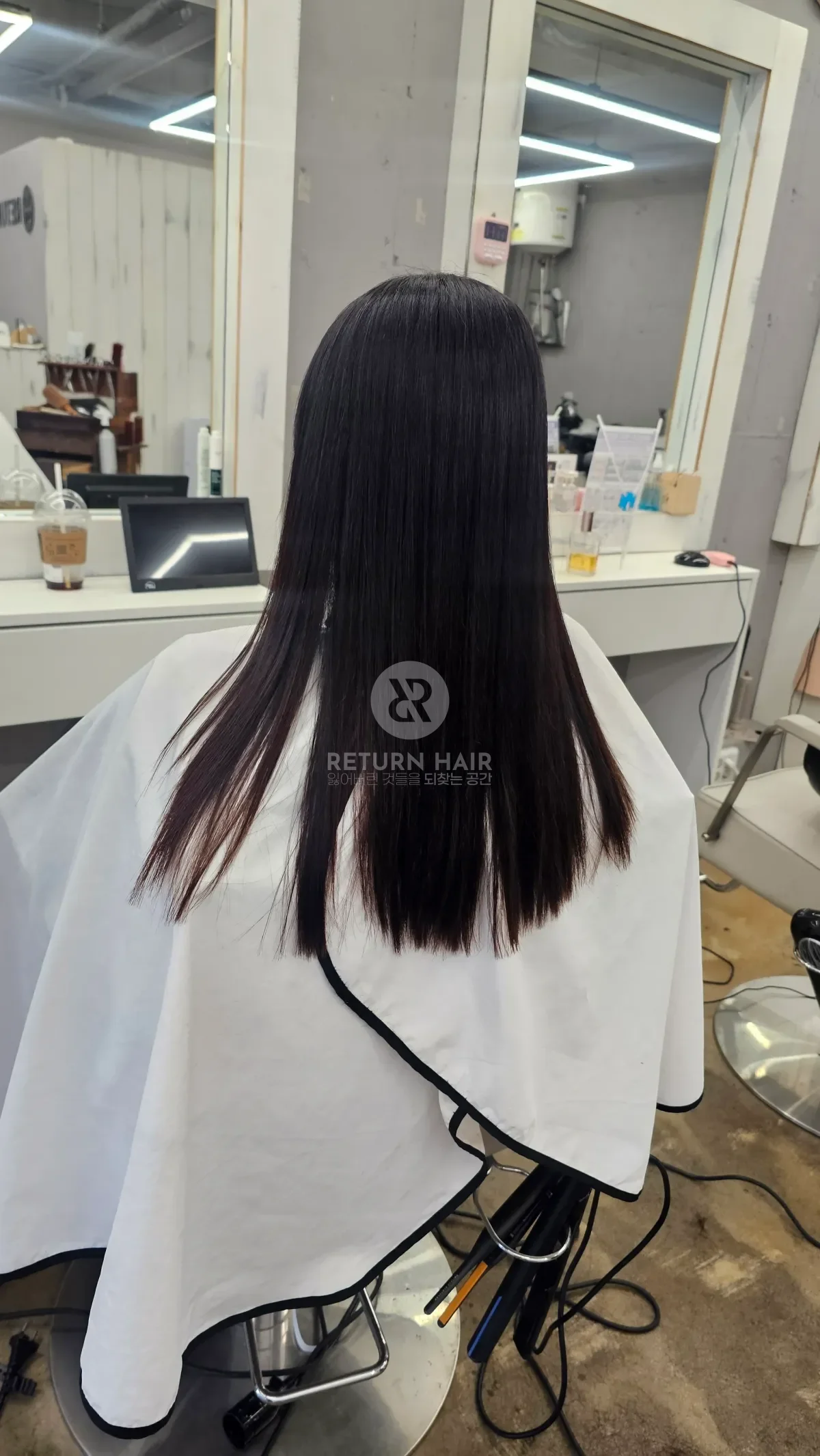 리턴 복구매직 시술 후 결과 사진