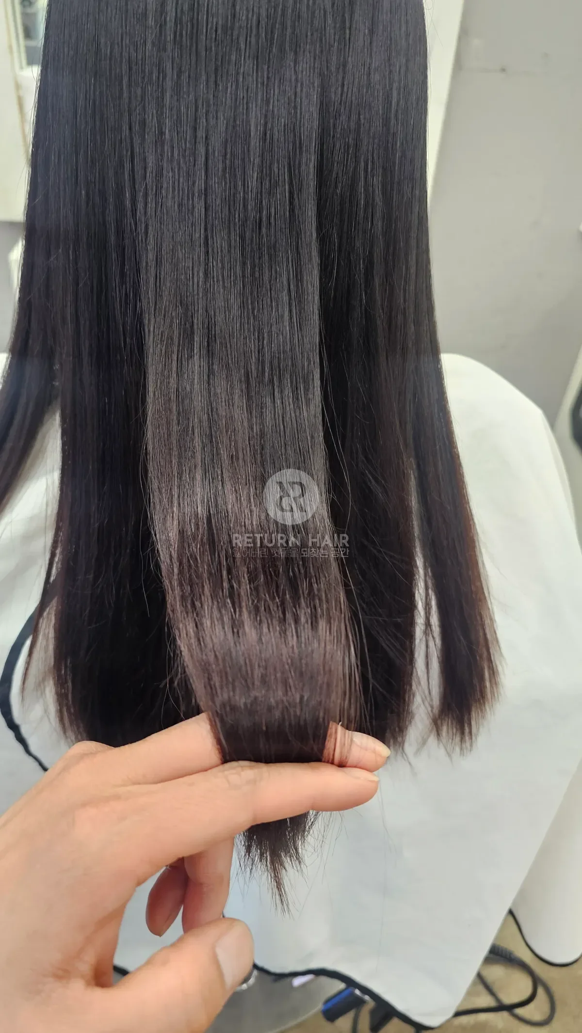 리턴 복구매직 시술 후 결과 사진 3