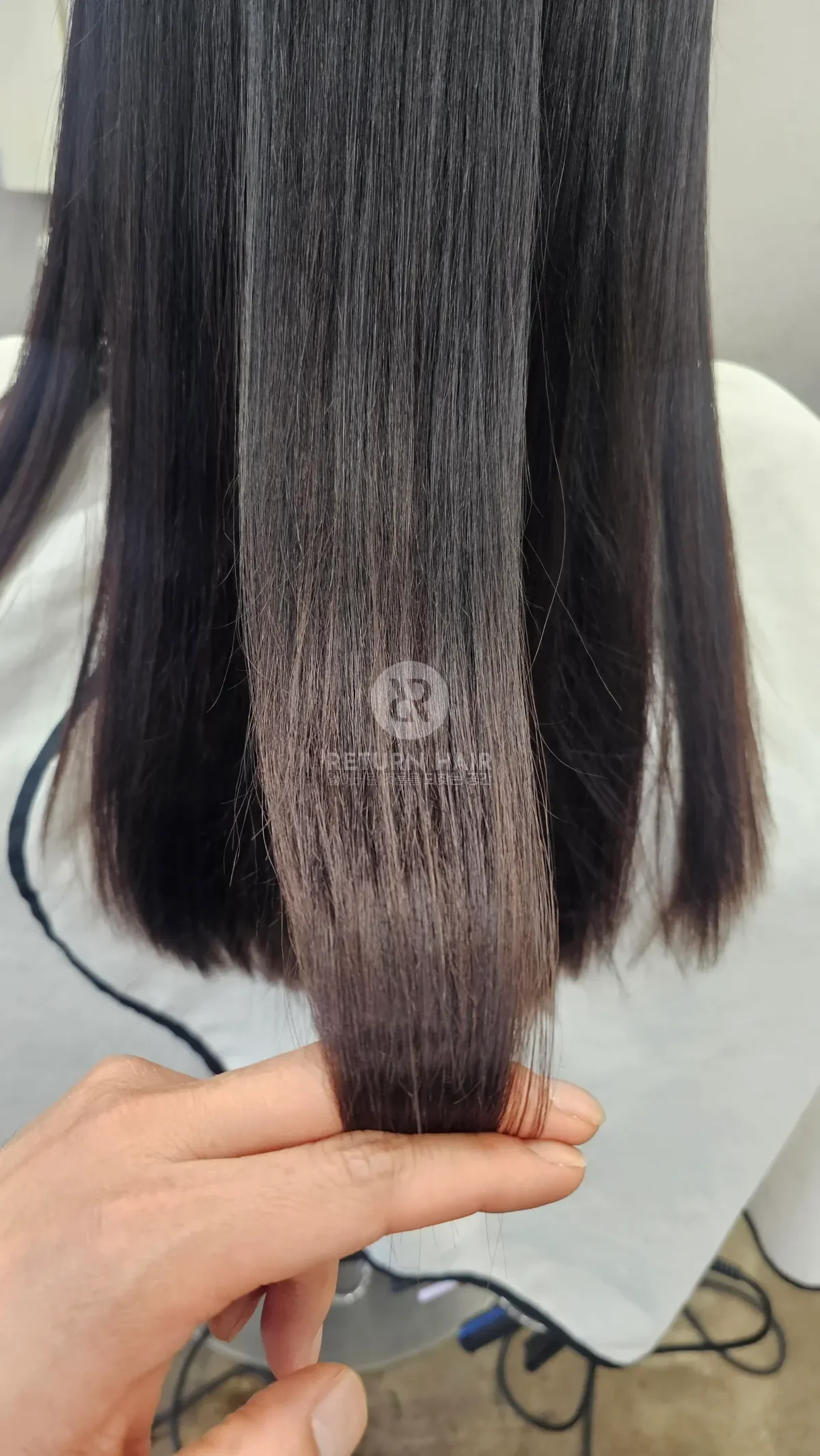 리턴 복구매직 시술 후 결과 사진 4