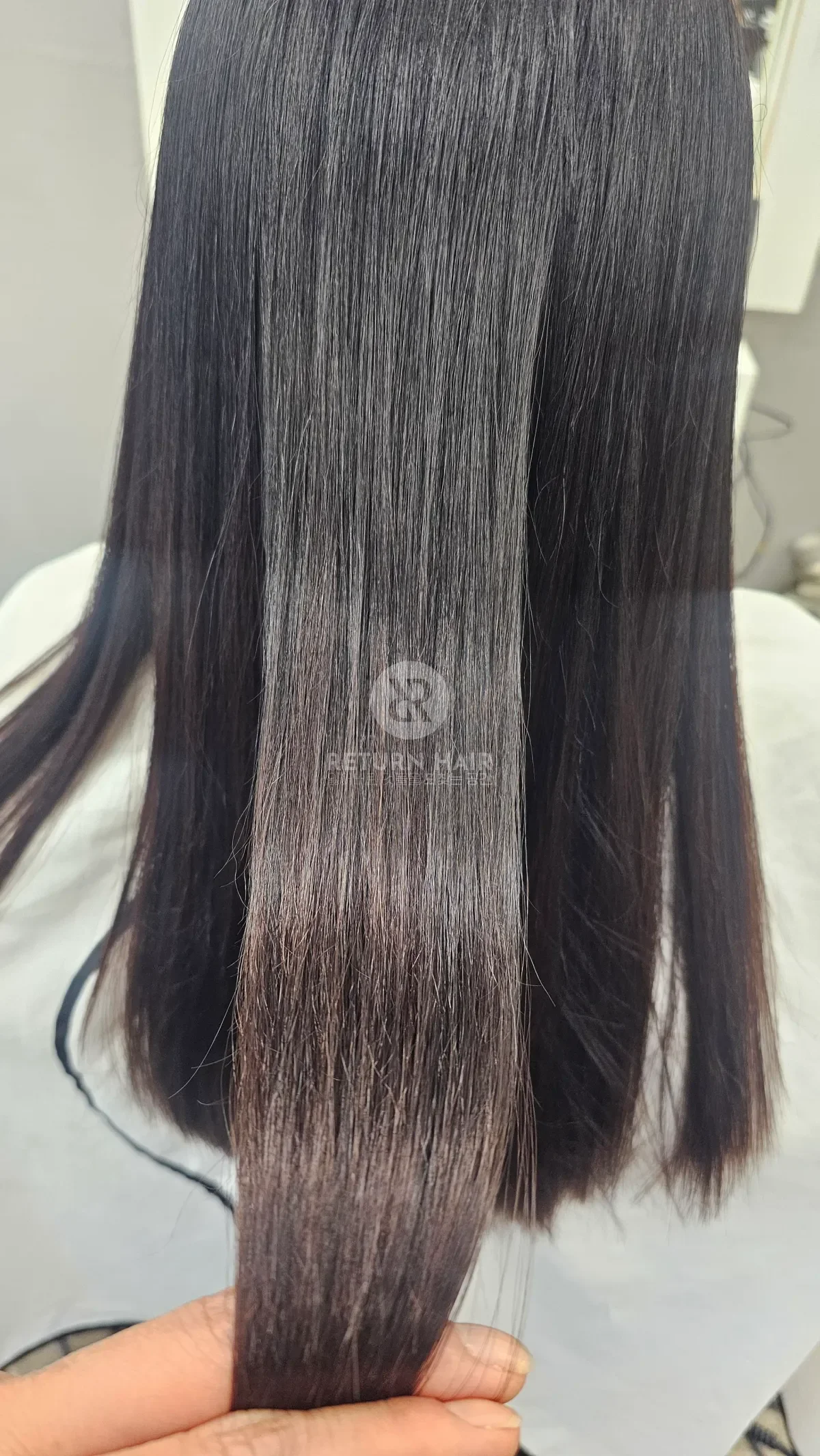 리턴 복구매직 시술 후 결과 사진 5