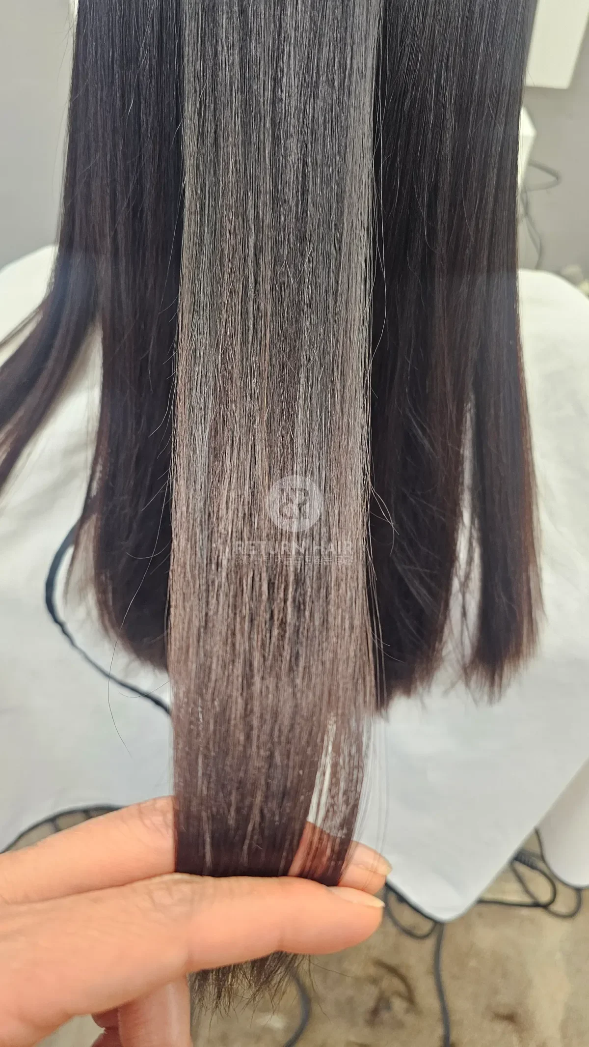 리턴 복구매직 시술 후 결과 사진 6