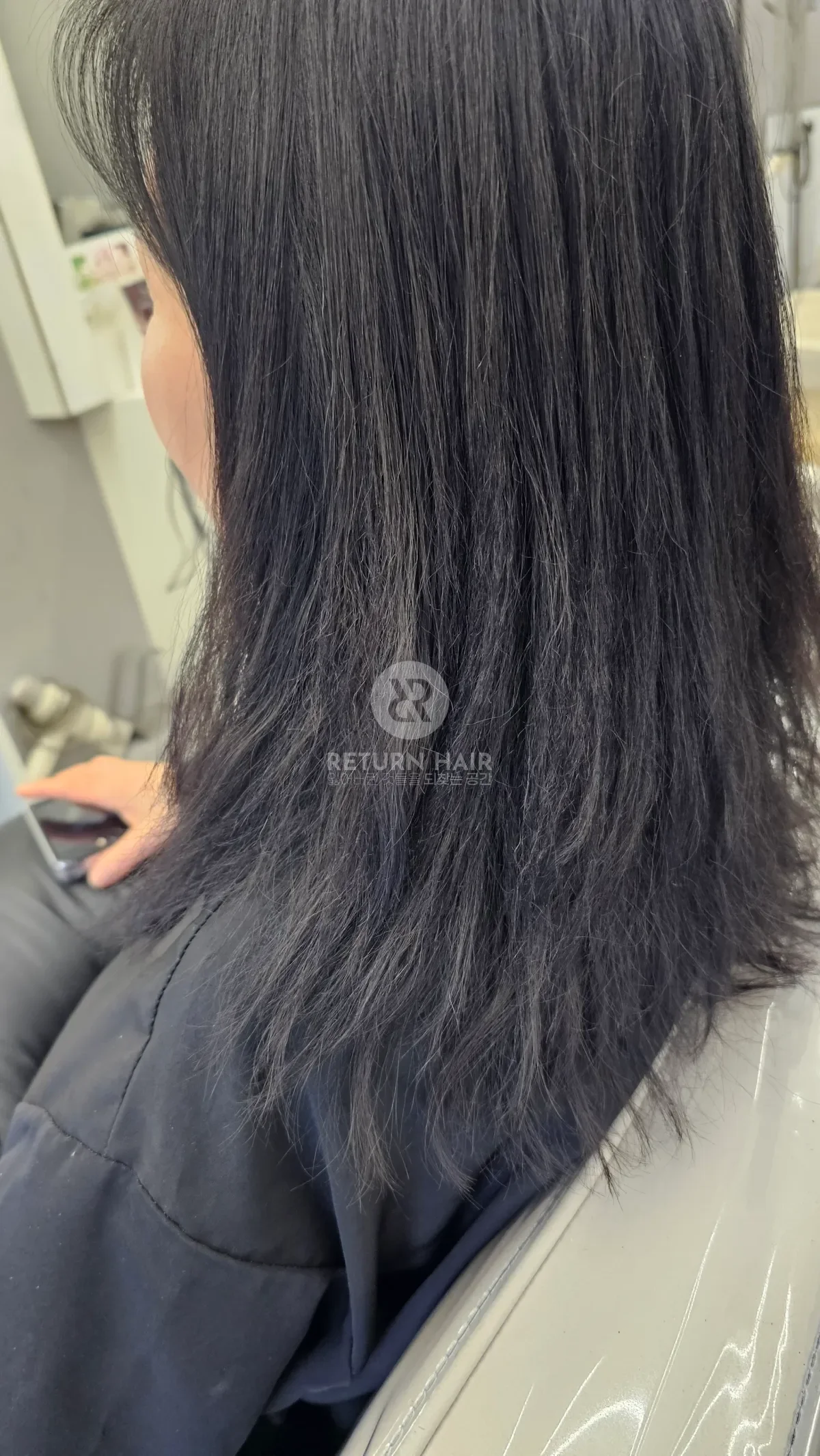 리턴 복구매직 시술 전 사진 2