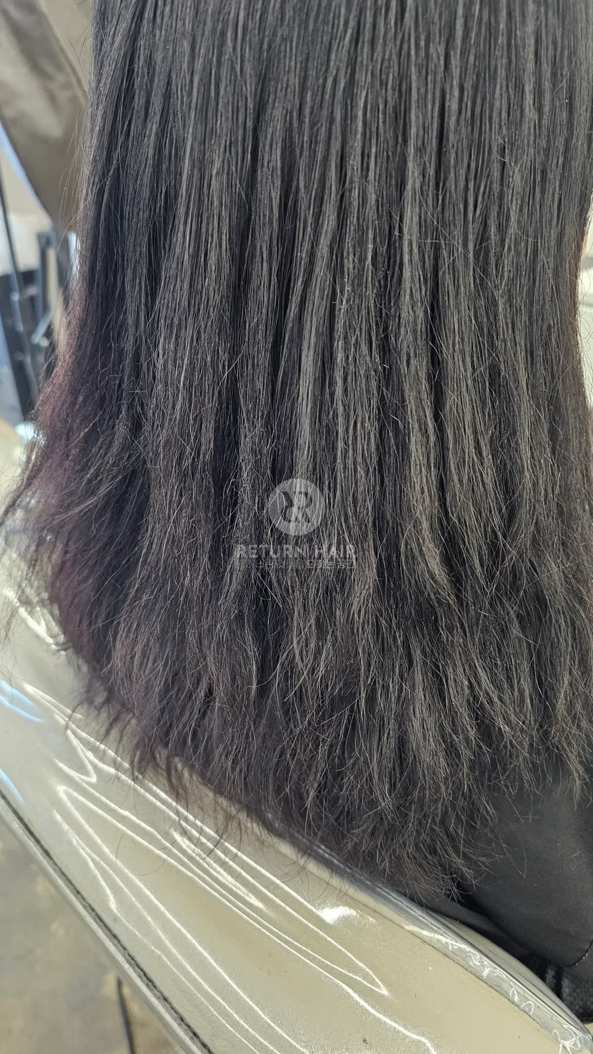 리턴 복구매직 시술 전 사진 4