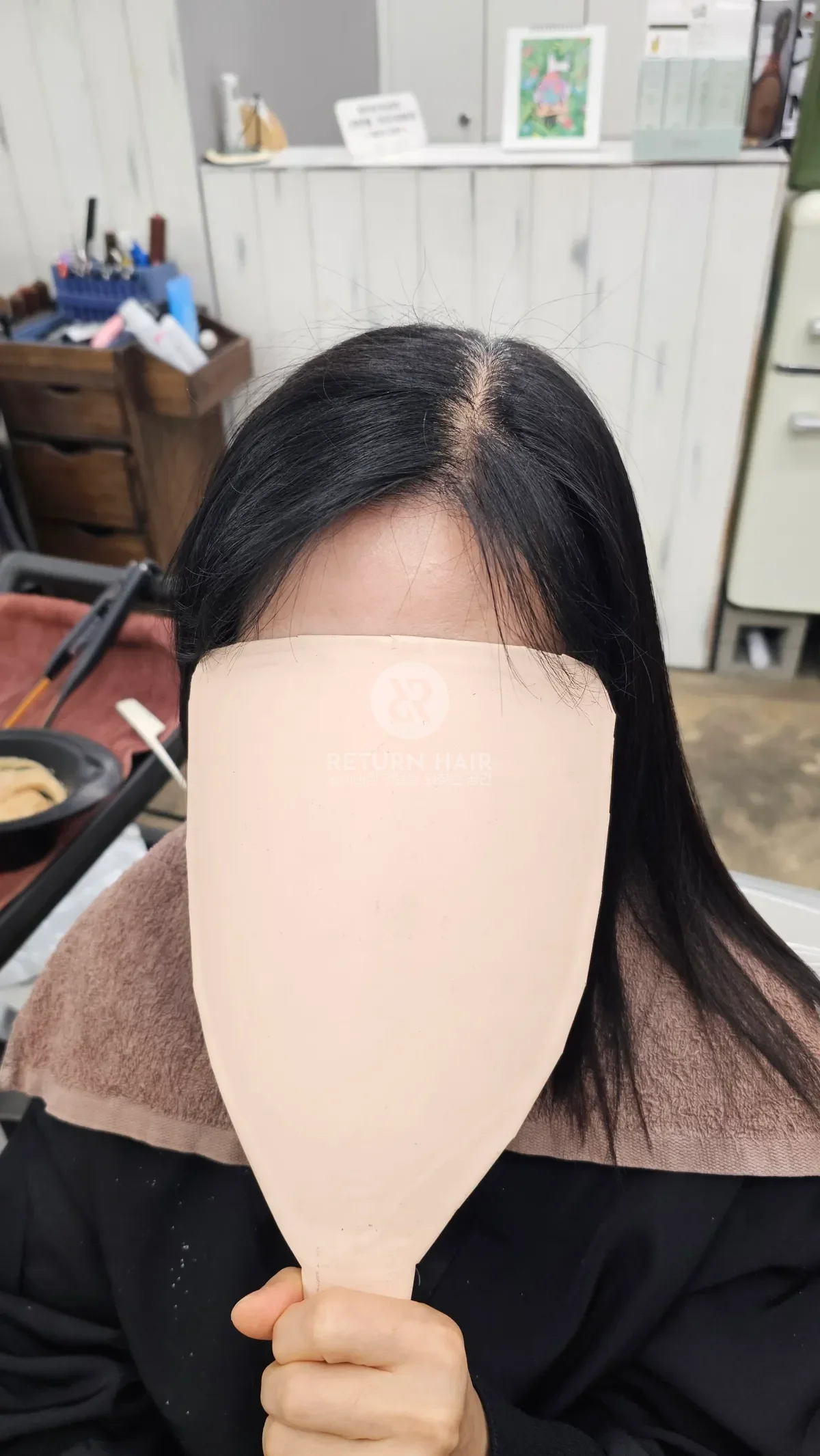 리턴 복구매직 시술 후 결과 사진 2