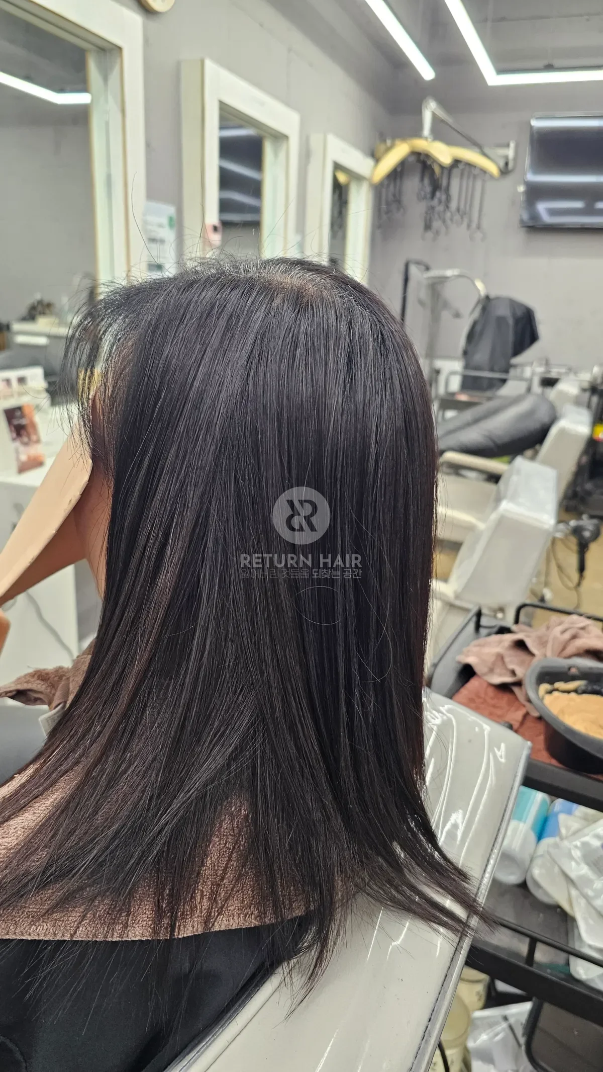 리턴 복구매직 시술 후 결과 사진 3