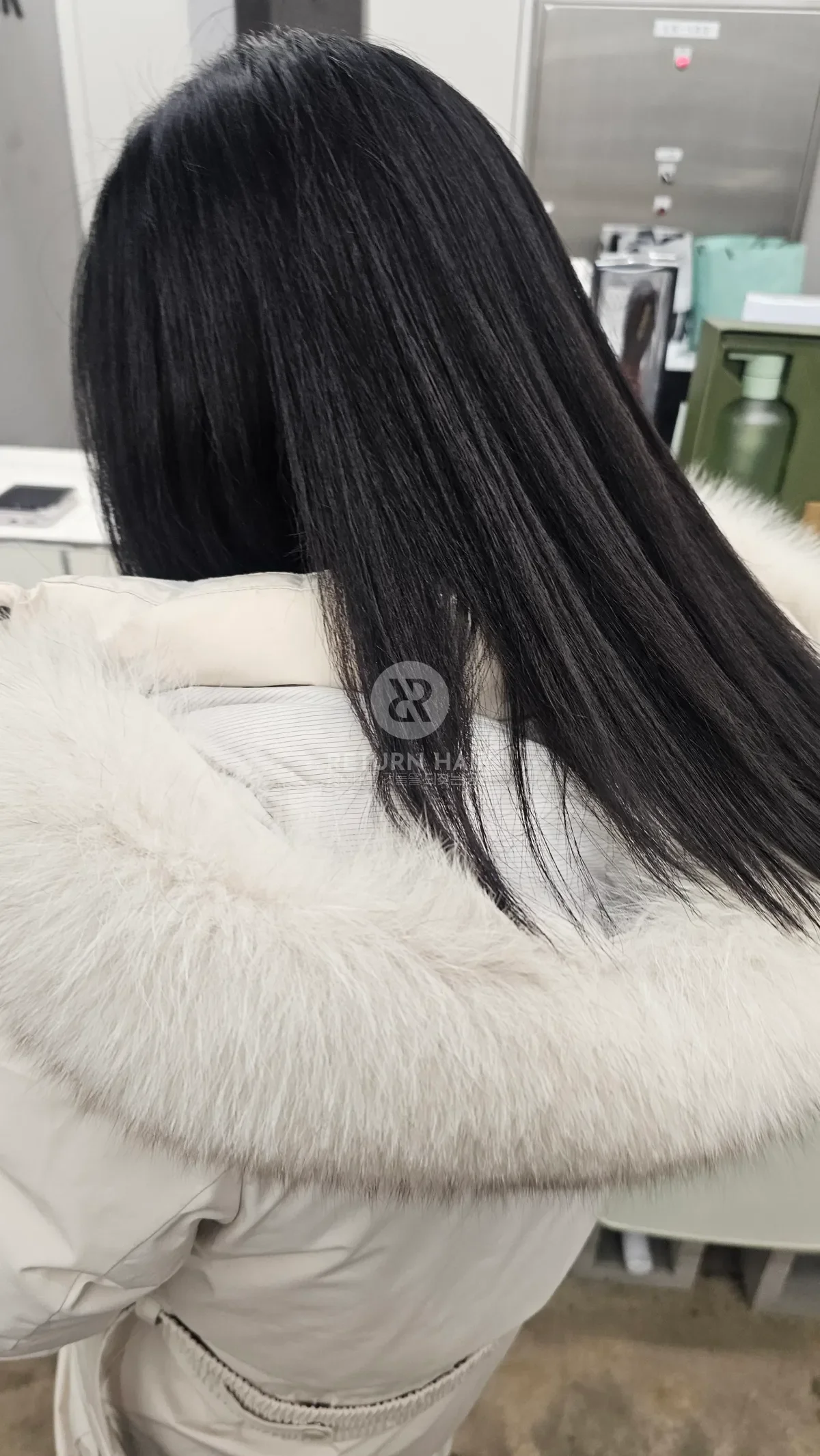 리턴 복구매직 시술 후 결과 사진 4