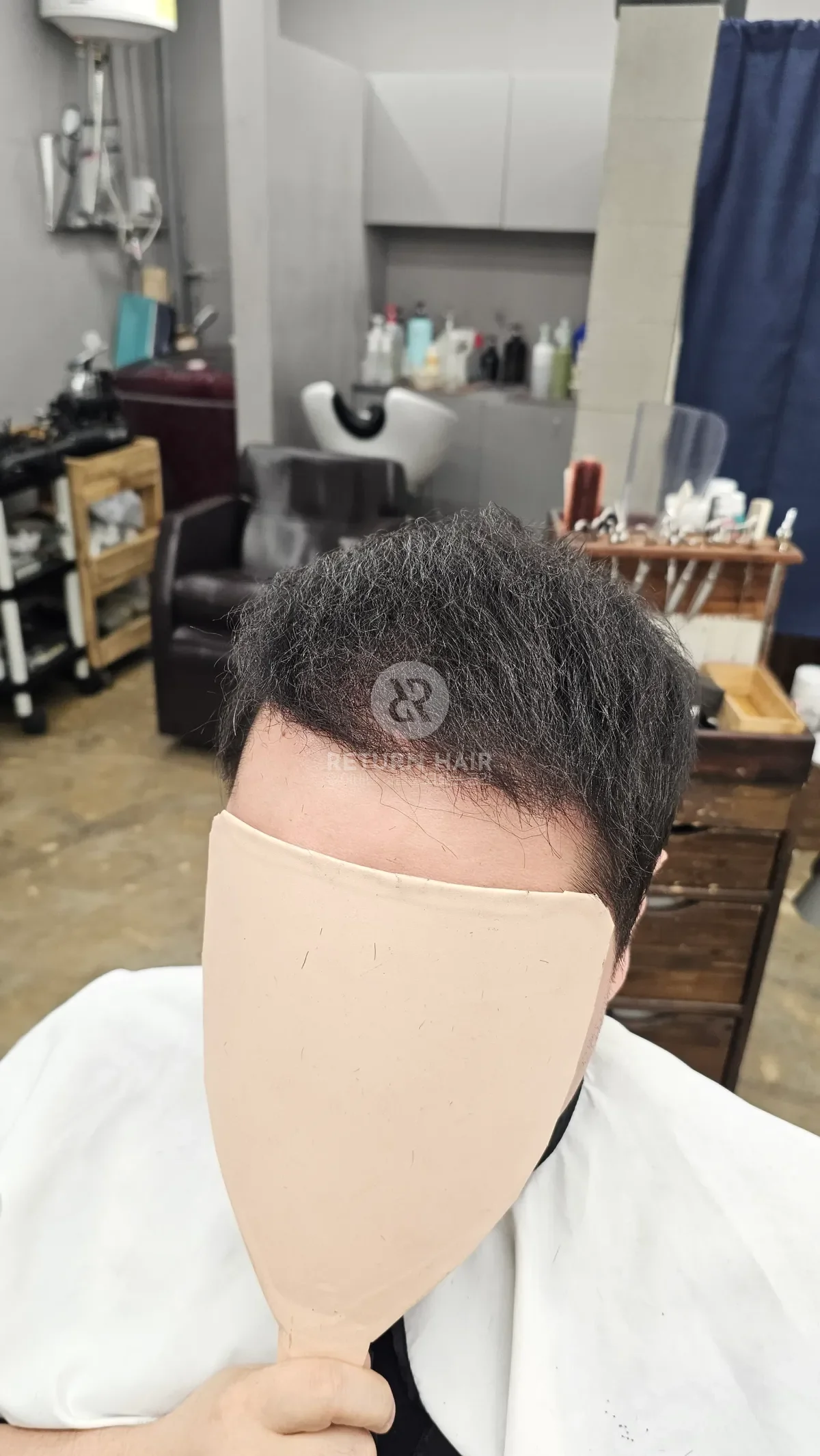 탈모 치트펌 파마 시술 후 결과 사진 3