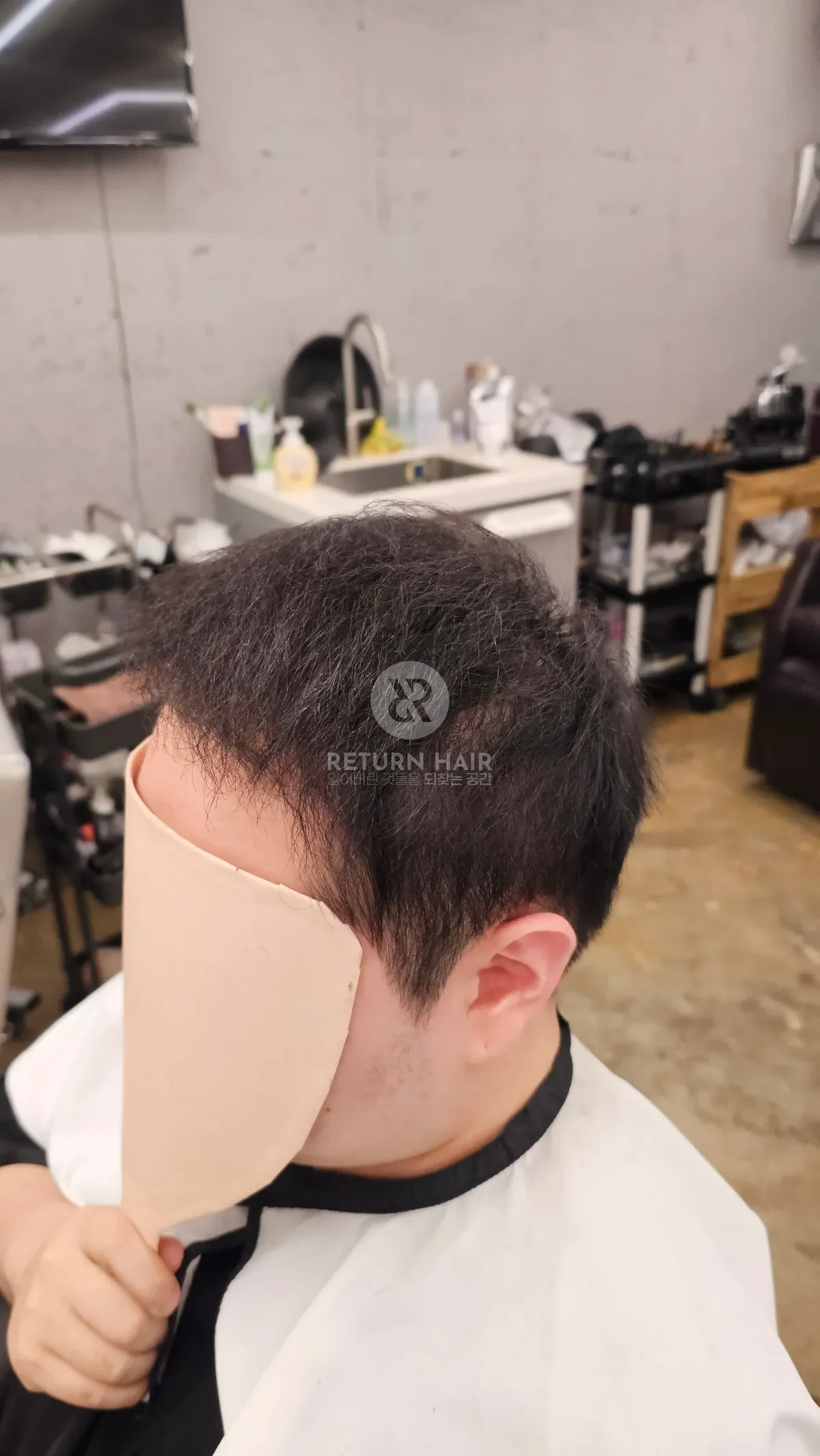 탈모 치트펌 파마 시술 후 결과 사진 4