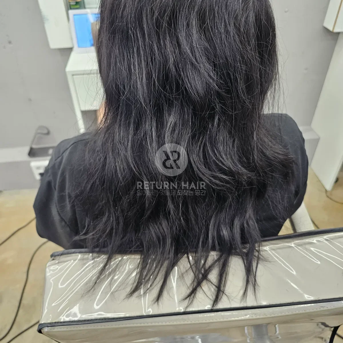 리턴 복구셋팅펌 시술 전 사진