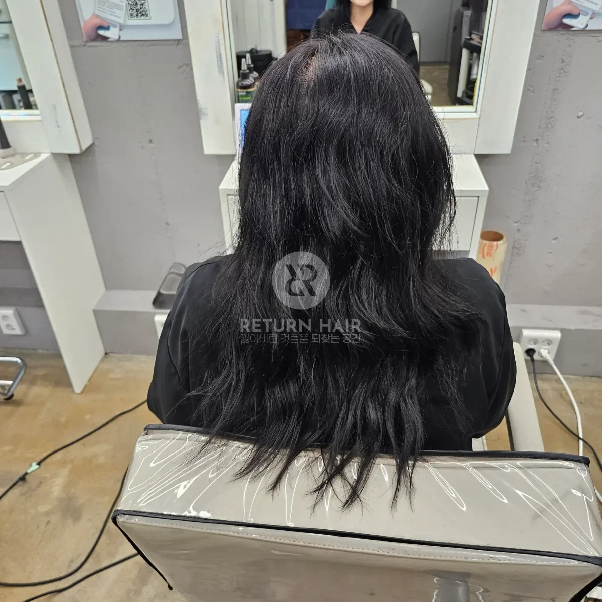 리턴 복구셋팅펌 시술 전 사진 2