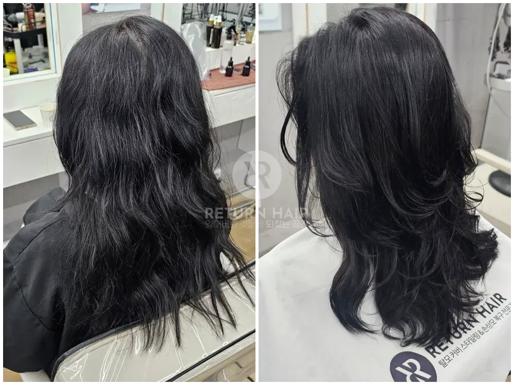 리턴 복구셋팅펌 시술 후 결과 사진 3