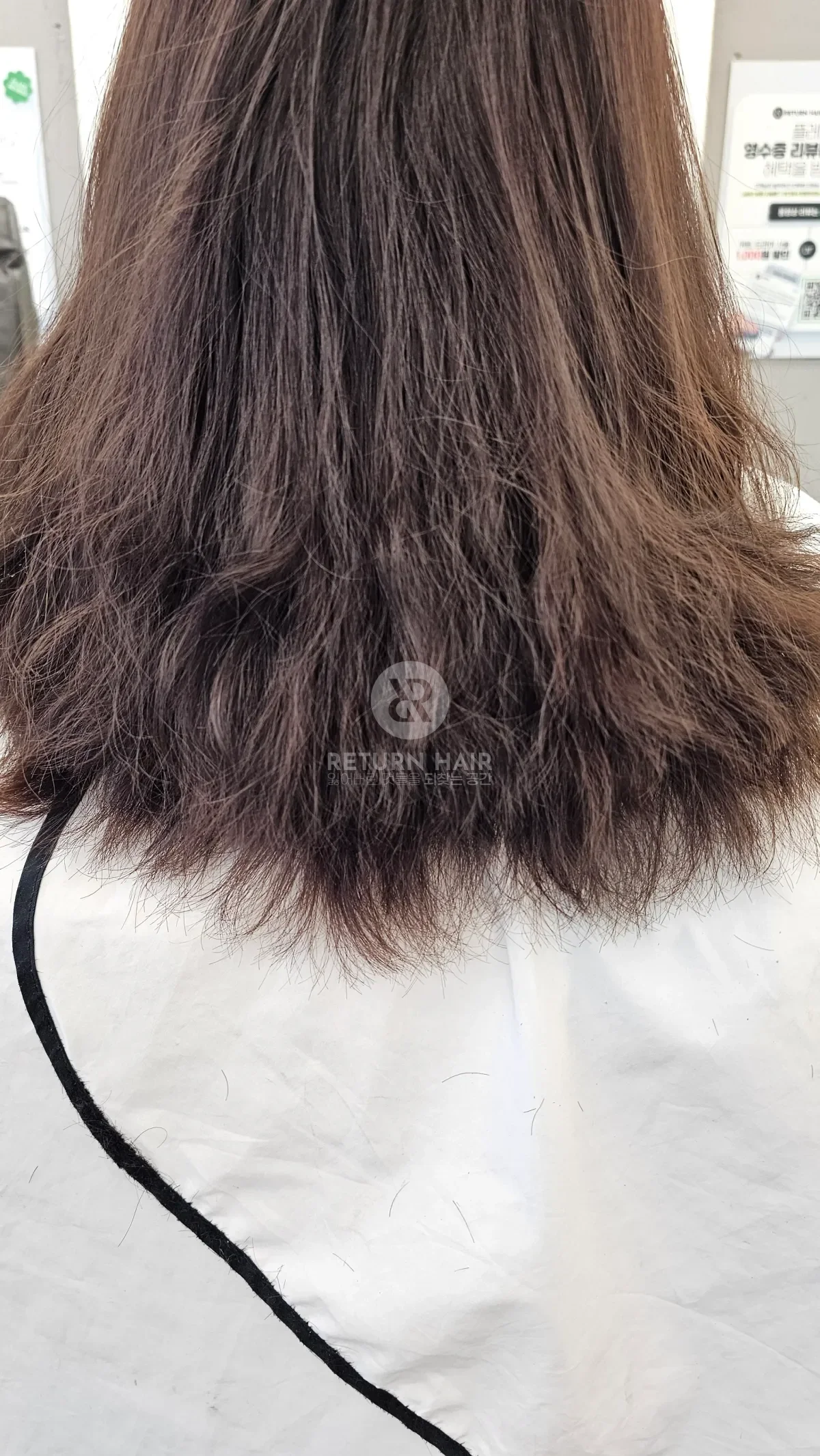 리턴 복구셋팅펌 시술 전 사진