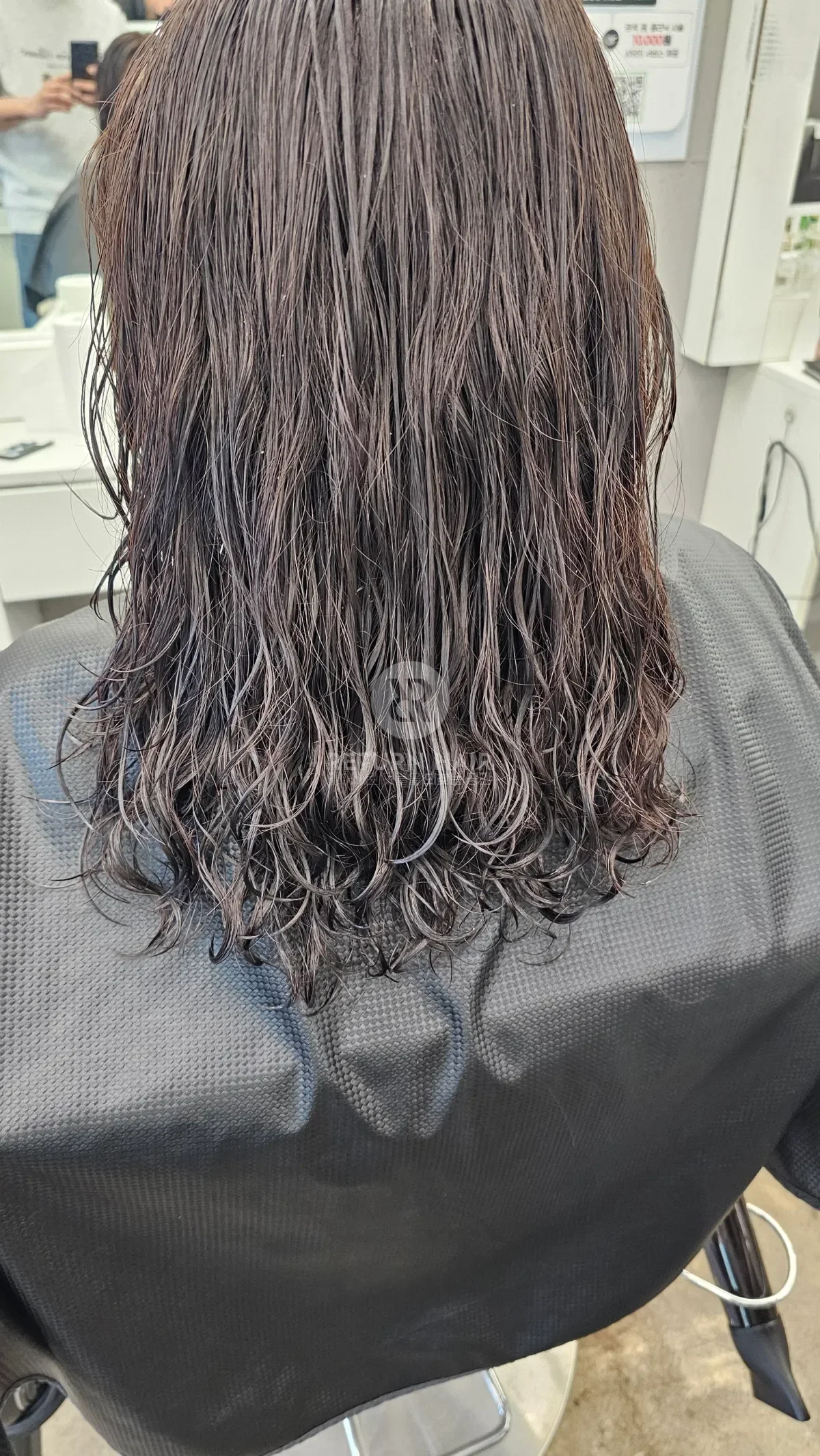 리턴 복구셋팅펌 시술 전 사진 4