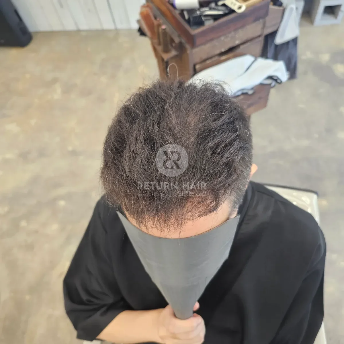 탈모 치트펌 파마 시술 후 결과 사진 2