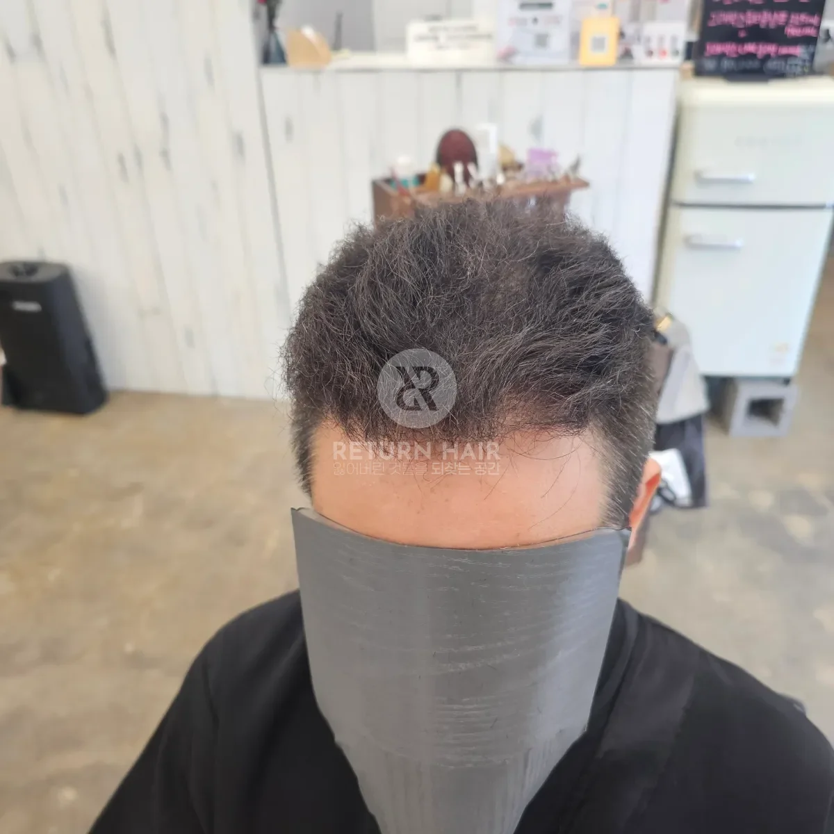 탈모 치트펌 파마 시술 후 결과 사진 3