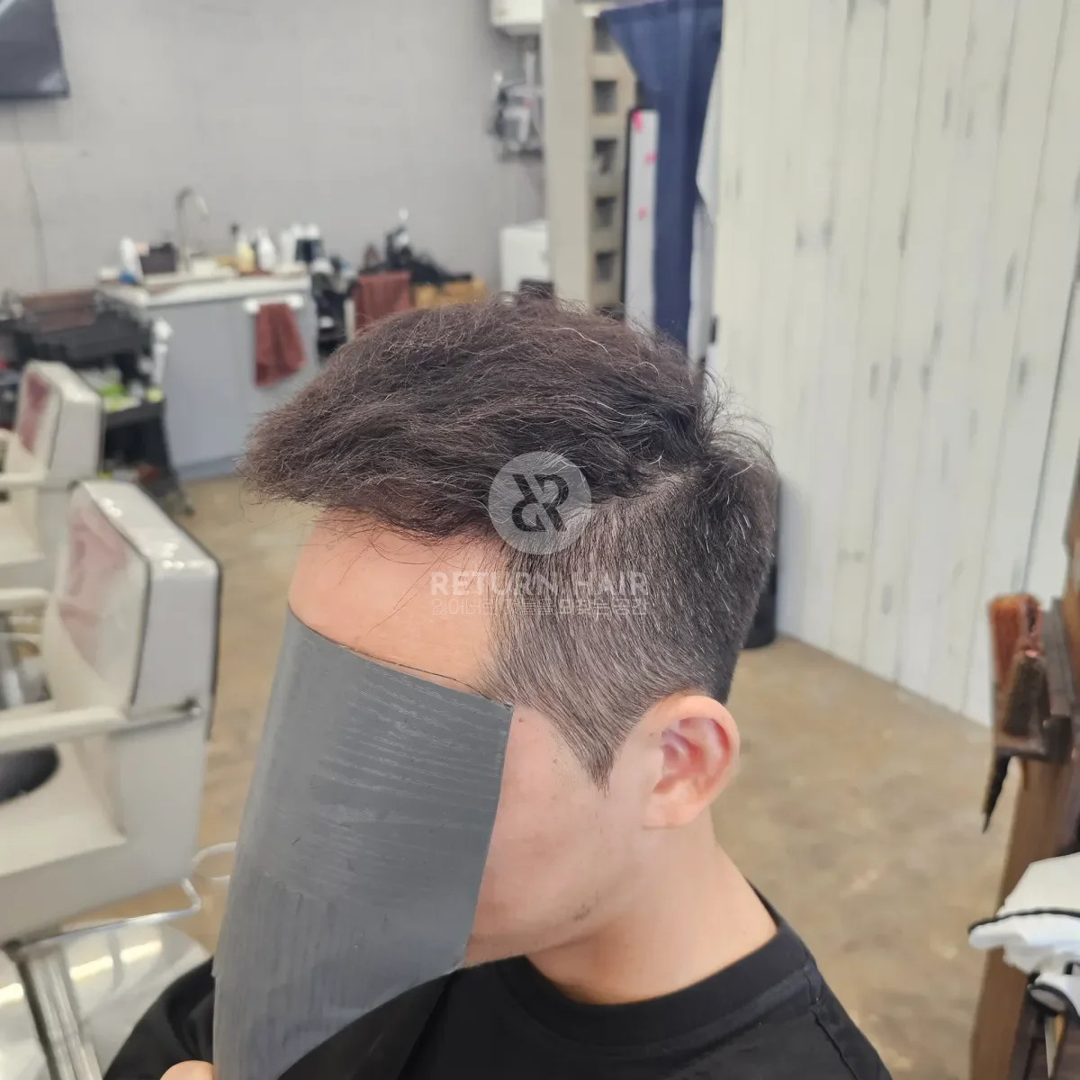 탈모 치트펌 파마 시술 후 결과 사진 4